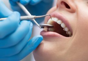 Seguro-odontológico